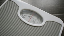 CUF vai participar em estudo sobre tratamento da obesidade