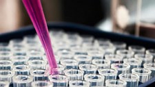 Novo instituto de investigação em medicina molecular
