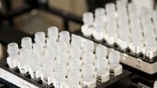 Projeto recebe 10 milhões de euros para estudar como as células moldam o seu ambiente