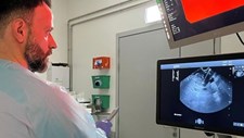 ULS Braga usa técnica pouco invasiva para tumor do pâncreas